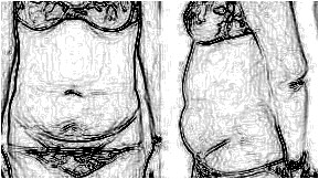 Abdomen / Body