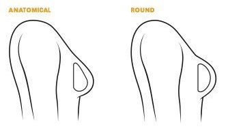 Breast Augmentation